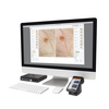 HEINE Cube System and HEINE iC1 Dermatoscope examination 