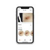 HEINE DERM App Patienten auf Smartphone