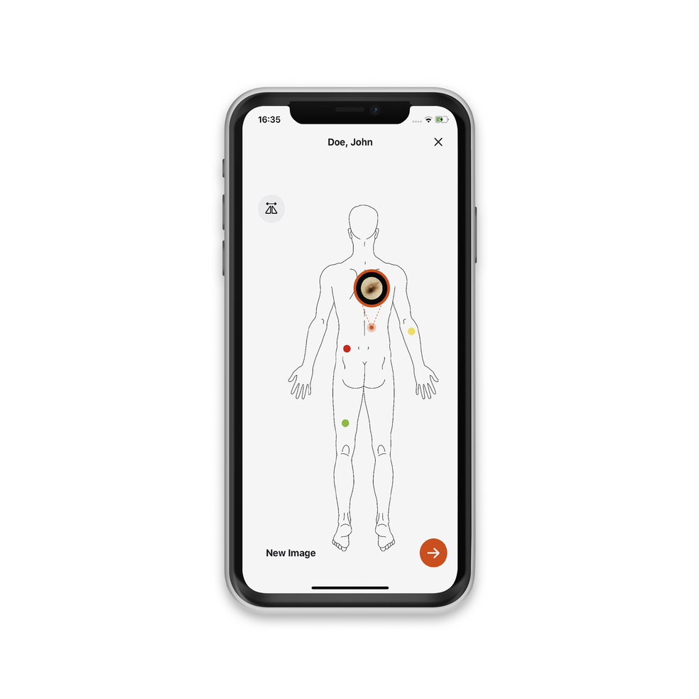 HEINE DERM App Bodymap on Smartphone