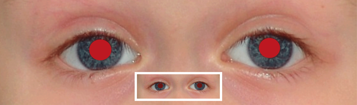 test ocular miopie online)